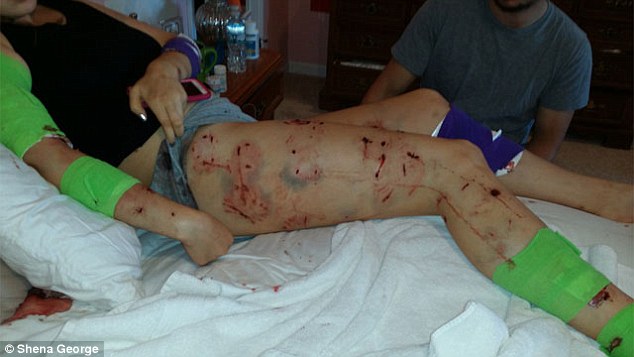 “The Day Everything Changed”: Two Young Joggers Survive 30-Minute Dog Attack in Rural Indiana