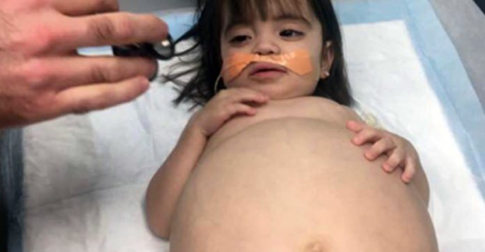 Baby Who Looked 8 Months’ Pregnant Due To Disease Is Saved By Dad’s Kidney Donation