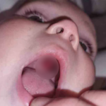 Mother rushed her baby to hospital thinking he has a hole in his mouth ‘only to discover the chilling truth’!