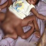 Woman collapsed when she saw the baby, ‘then the doctors did something incredible’!