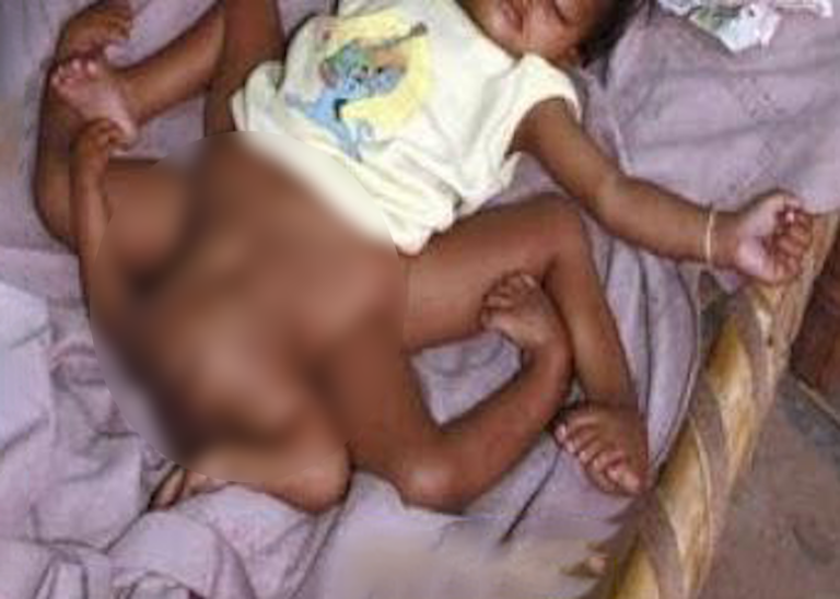 Woman collapsed when she saw the baby, ‘then the doctors did something incredible’!