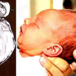Doctors saw something coming out of baby’s head; ‘when they realized what it was, it left them in disbelief’!