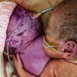 Doctors put newborn next to her dying sister, ‘what the baby did next left the doctors dazed’!