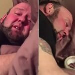 After Dental Surgery, Man Turns To Tape To ‘Keep His Head On’