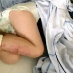 3-Year-Old Hospitalized After Beach Trip, Family Shares Urgent Safety Warning