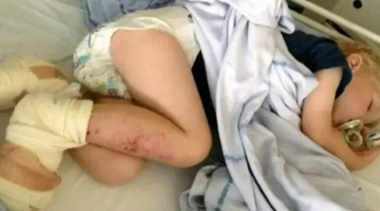 3-Year-Old Hospitalized After Beach Trip, Family Shares Urgent Safety Warning