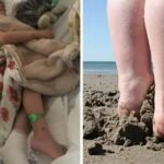 Toddler Injured In Beach Accident, Parents Share Important Safety Warning