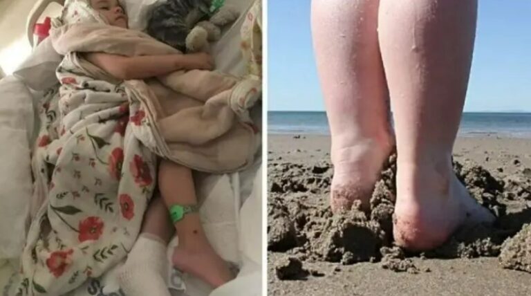 Toddler Injured In Beach Accident, Parents Share Important Safety Warning