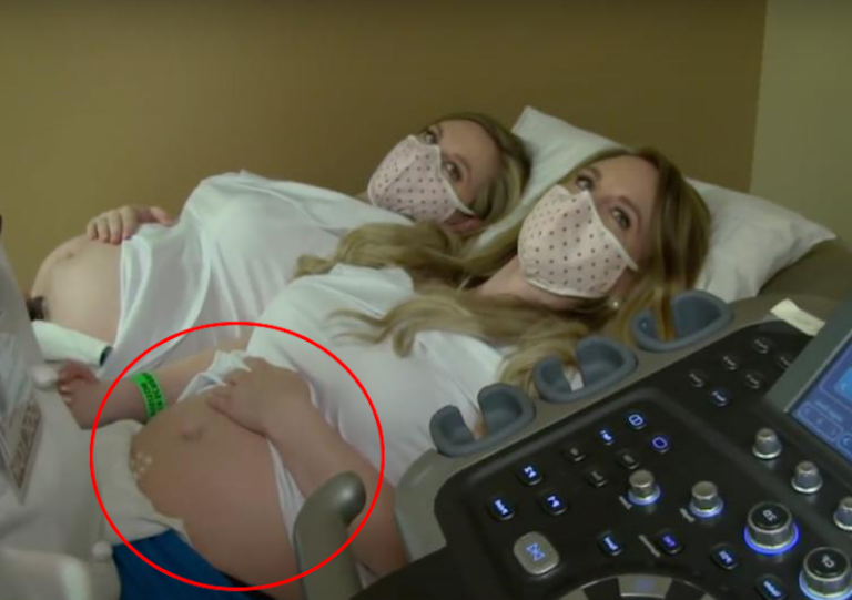 Twin sisters married to twin brothers get pregnant together — what the doctor found is remarkable