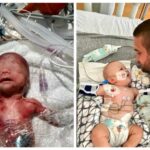 Born at just 1 pound and kept in the NICU for 113 days, this preemie is now a flourishing three‑year‑old