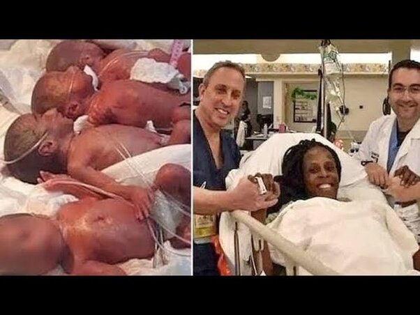 Woman’s delivery of 11 “babies” takes unexpected turn when doctors examine one of them