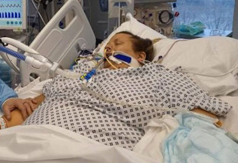 What she thought was a cold leaves woman in a coma and facing major amputations