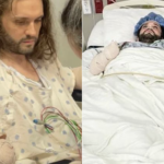 Man suffers double amputation after routine bite leads to catastrophic infection