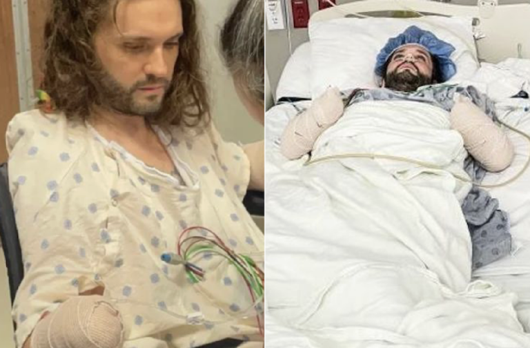 Man suffers double amputation after routine bite leads to catastrophic infection