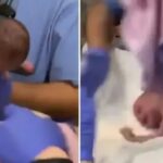 Premature Newborn Dropped On Head In Delivery Room By Careless Doctor