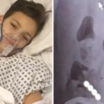 Mom Warns Parents After A New ‘School Dare’ Nearly Killed Her 12-Year-Old Son