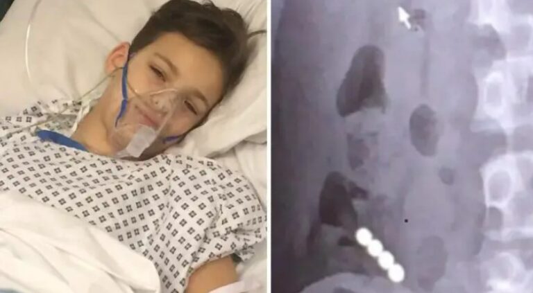 Mom Warns Parents After A New ‘School Dare’ Nearly Killed Her 12-Year-Old Son