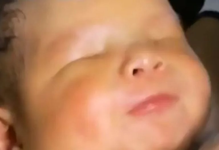 Parents say their baby didn’t open his eyes for a week, ‘devastated after they found out the troubling truth’!