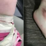 Daycare Workers Fired For Doing This To A 17-Month-Old Who Kept Taking Off Her Shoes