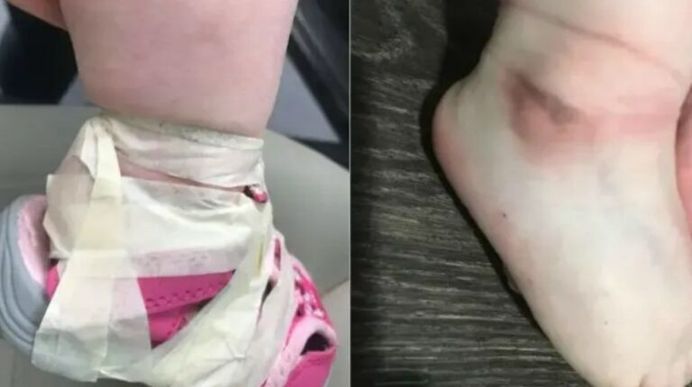 Daycare Workers Fired For Doing This To A 17-Month-Old Who Kept Taking Off Her Shoes