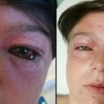 Boy Forced Into ‘Roundabout Of Death’ Playground Stunt Left With Serious Head Injuries