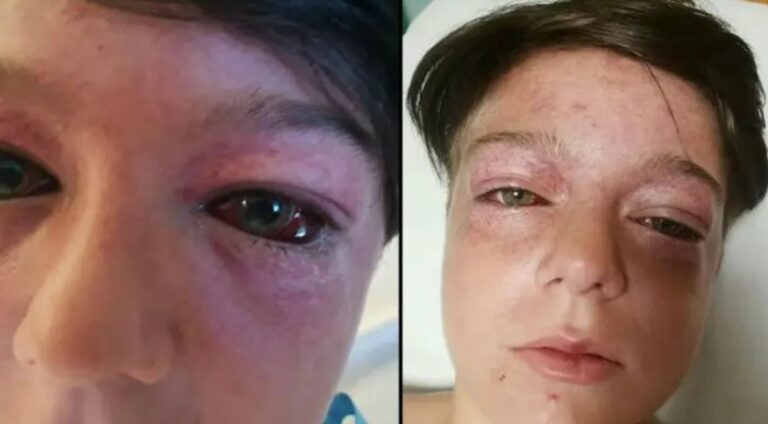Boy Forced Into ‘Roundabout Of Death’ Playground Stunt Left With Serious Head Injuries