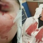 Boy Almost Blinded After Bully Smashes His Glasses Leaving Him Covered In Blood