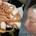 Woman Complains of a Severe Headache—Then a Nurse Notices Something Terrifying