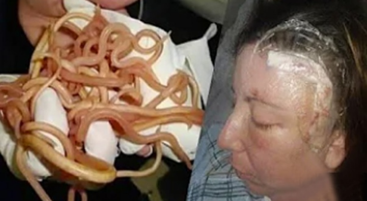 Woman Complains of a Severe Headache—Then a Nurse Notices Something Terrifying