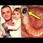 Dentists found out the reason of this father’s death after ignoring a toothache