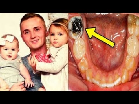 Dentists found out the reason of this father’s death after ignoring a toothache