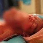 A strange growth appeared on a newborn’s neck; when doctors learned what it was, they were stunned