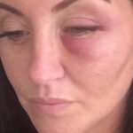 Five days after a stroke left her paralyzed from the waist down, her husband filed for divorce — but the mom later delivered the perfect revenge