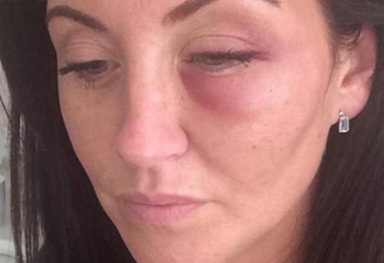 Five days after a stroke left her paralyzed from the waist down, her husband filed for divorce — but the mom later delivered the perfect revenge