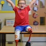 A boy who lost both legs struggled to get around — until a life‑changing moment transformed everything