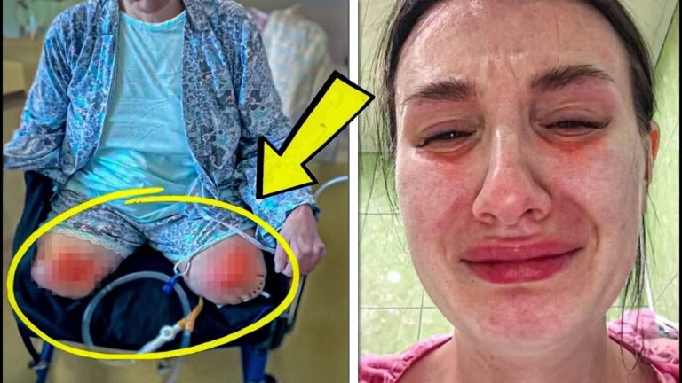 A Routine C‑Section Turns Into a Nightmare When a Mother Realizes Her Legs Were Amputated