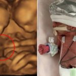 Unborn Baby Girl Sends Strange Signals From the Womb — Doctors’ Discovery Leaves Everyone Astonished
