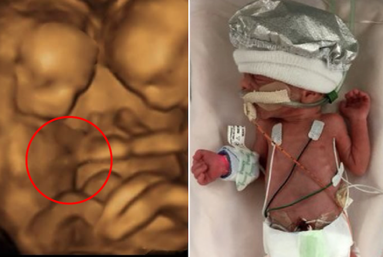 Unborn Baby Girl Sends Strange Signals From the Womb — Doctors’ Discovery Leaves Everyone Astonished