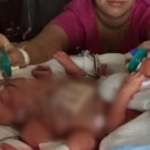 Mother Collapses in Shock at the Sight of Her Baby — Doctors’ Explanation Is Absolutely Unbelievable