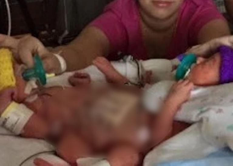 Mother Collapses in Shock at the Sight of Her Baby — Doctors’ Explanation Is Absolutely Unbelievable