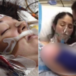Mom Slips Into a Coma After C‑Section and Is Put on a “Last‑Chance” Ventilator — One Nurse’s Idea Changes Everything