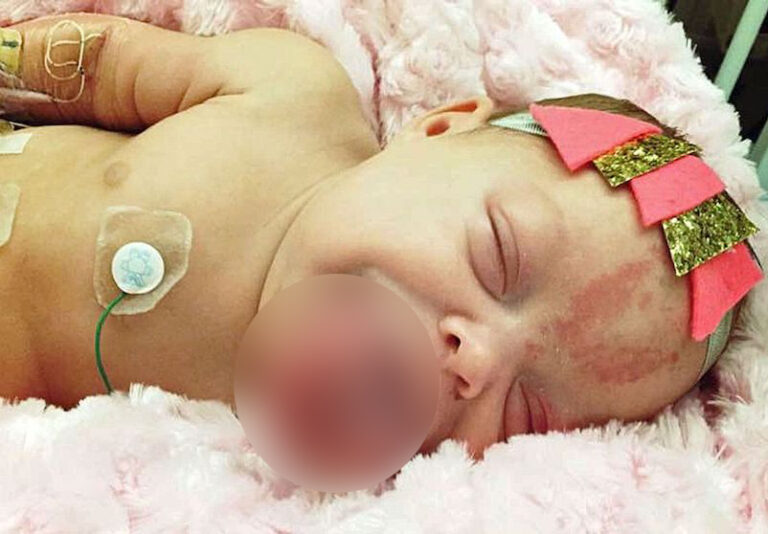 A Newborn Arrives With a Tongue Far Larger Than Expected — Doctors Step In With an Incredible Plan
