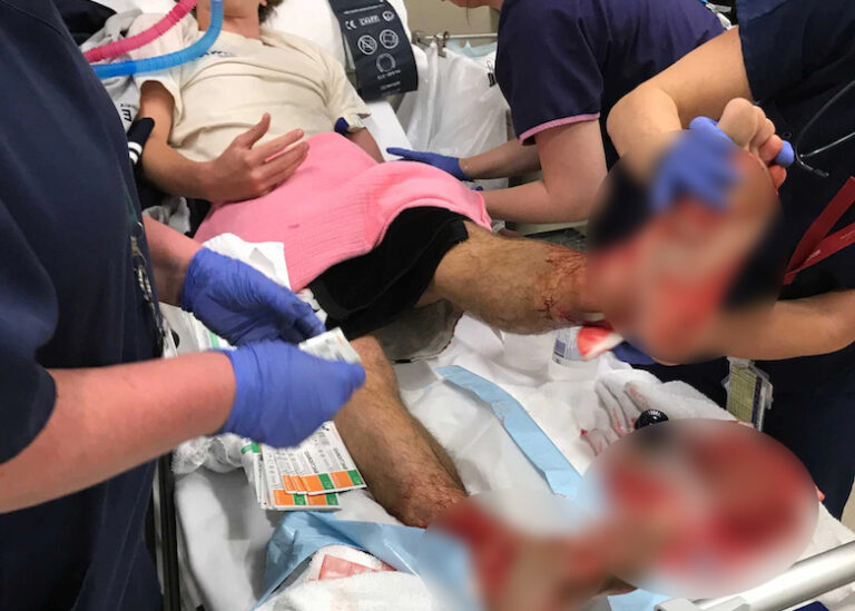 He Just Wanted to Cool Off… Until a Glance at His Legs Turned the Moment Into Pure Shock