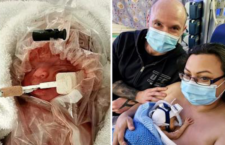 She Sees Doctors Cover Her Baby in a Plastic Bag — Her Reaction Leaves Everyone Stunned