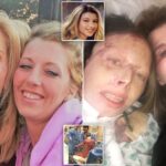Woman Brave Enough to Reveal Her Trauma After Being Set Ablaze by Her Boyfriend