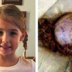 Go‑Kart Accident Leaves Young Girl Scalped, Prompting Her Parents to Issue a Serious Safety Alert